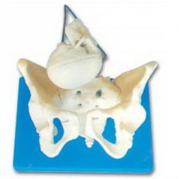 BIRTH DEMONSTRATION MODEL (BONY PELVIS WITH FETAL HEAD)